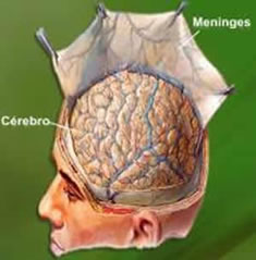 A meningite é uma doença que pode ser causada por bactérias ou vírus